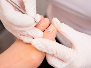 Como Fortalecer as Unhas Dicas e Tratamentos para Unhas Fracas e Quebradiças Como Fortalecer as Unhas Dicas e Tratamentos para Unhas Fracas e Quebradiças